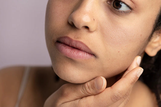 6 Home remedies for Open Pores